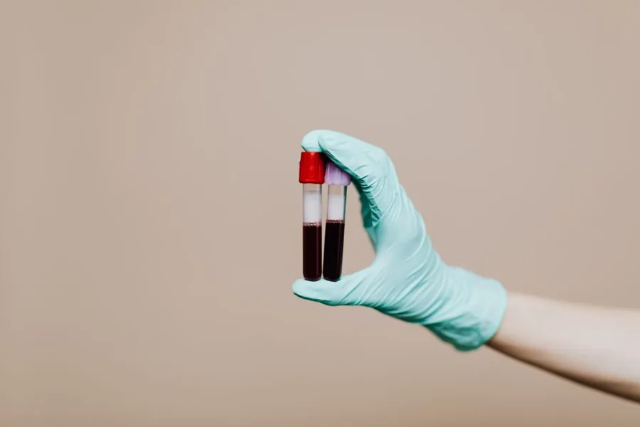 Gloved hand holding blood sample tubes